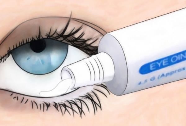 Закладывание мази в конъюнктивальный мешок