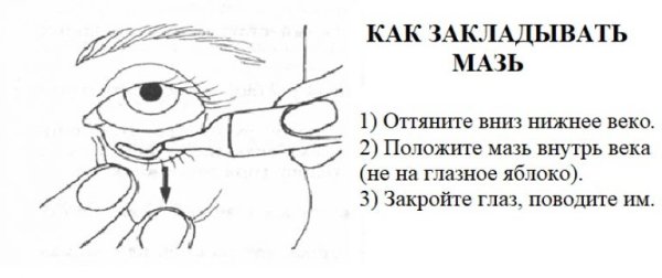 Закладывание мази на нижнее веко