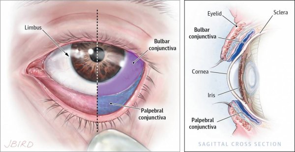 Конъюнктивит мешок конъюнктивальный