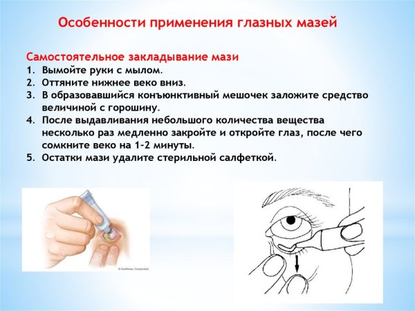 Закладывание мази за веко алгоритм