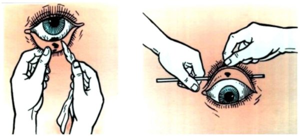 Анатомия глаза офтальмология атлас