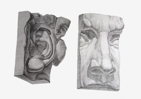 Ухо Давида гипс сбоку