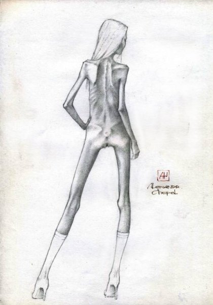 Анорексия иллюстрация