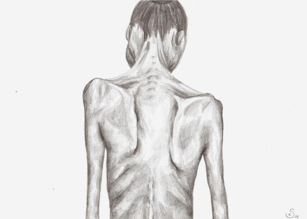 Александр Чепель анорексия