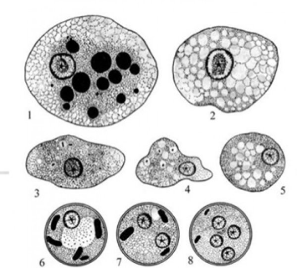 Лямблия (lamblia intestinalis). Циста