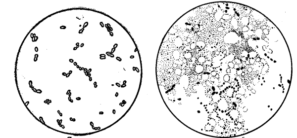 Молочнокислый стрептококк (Streptococcus lactis)