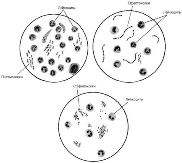 Пневмококки микробиология рисунок
