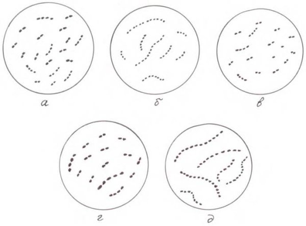 Молочнокислый стрептококк (Streptococcus lactis)