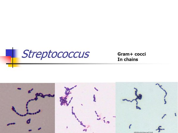 Streptococcus pyogenes рисунок микробиология