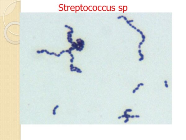 Streptococcus pyogenes рисунок