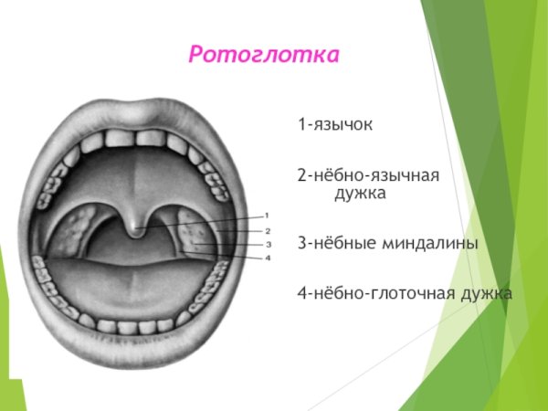 Воспаление небно глоточной дужки