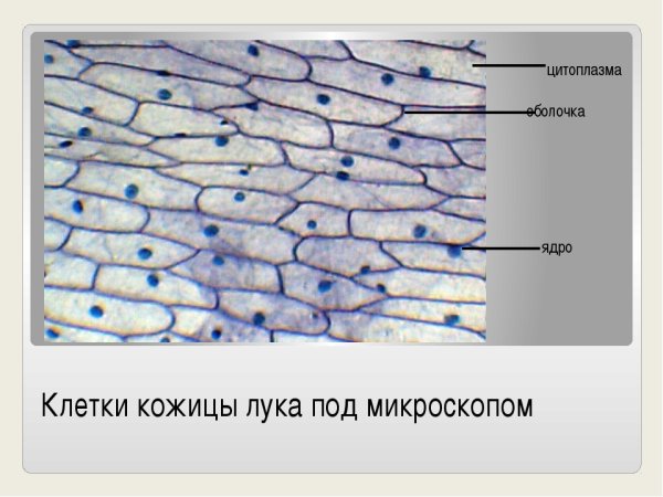 Строение клеток эпидермиса чешуи лука