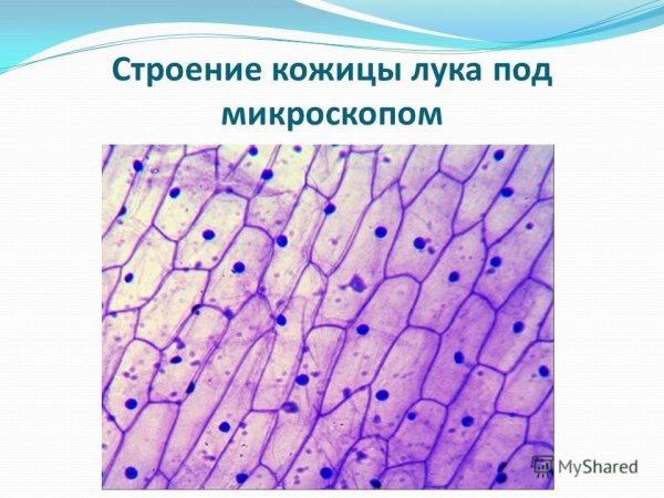 Клетки эпидермиса лука строение