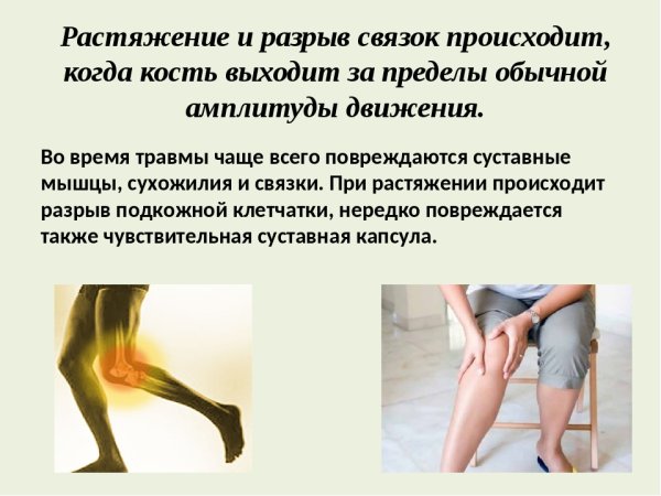 Растяжения и разрывы связок суставов