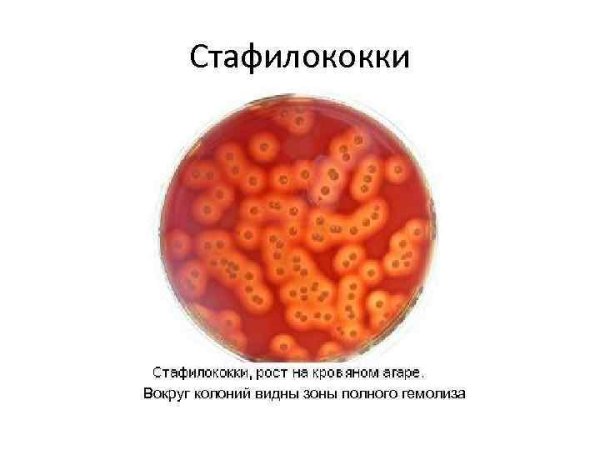 Стафилококки рисунок