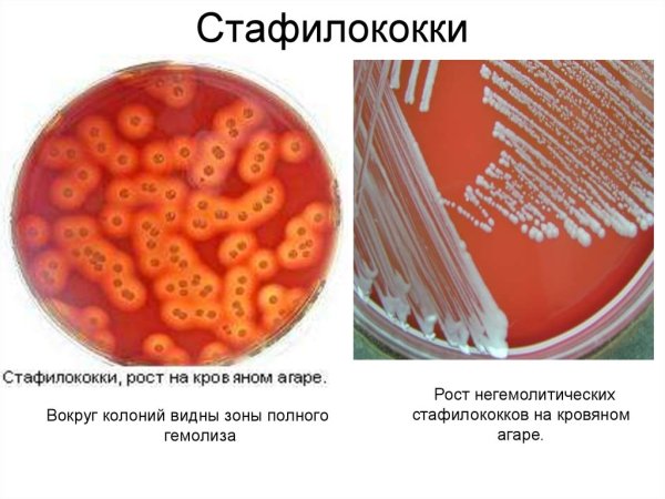 Культуральные Staphylococcus aureus на кровяном агаре