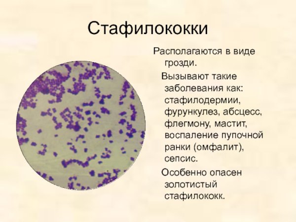 Борьба с микробами