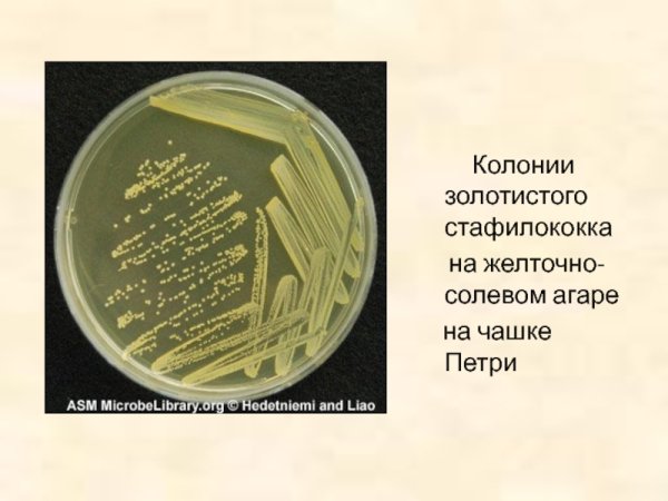 Стафилококкус ауреус