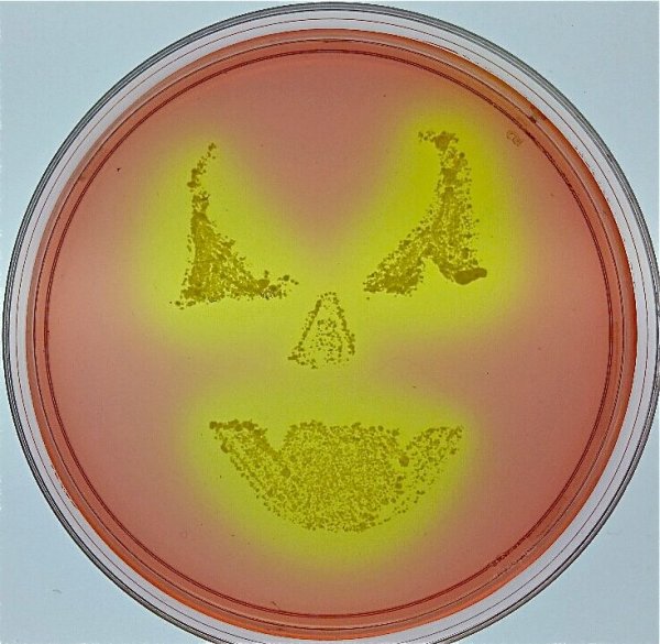 Стафилококки стрептококки кишечная палочка