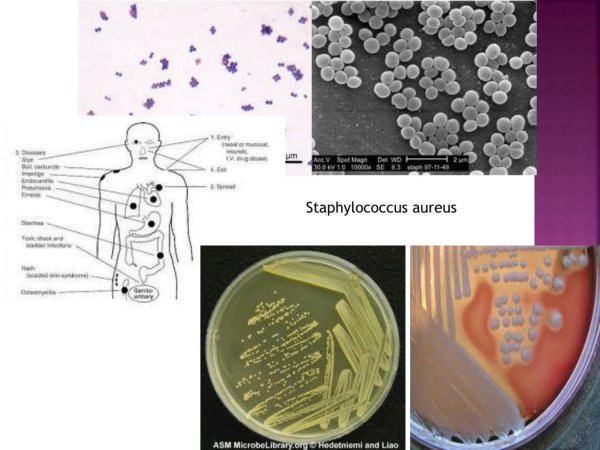Сарцины бактерии