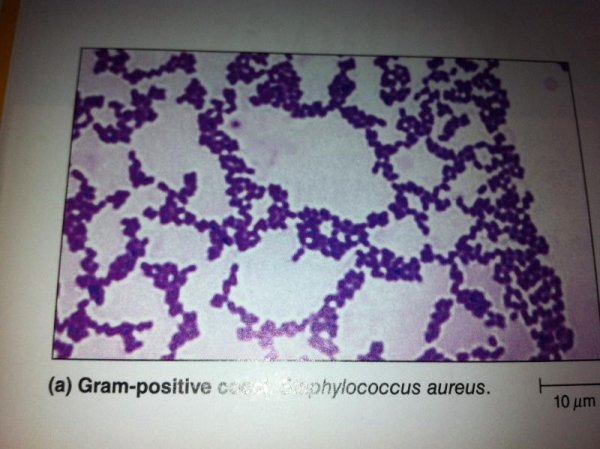 Бемории стафилококки