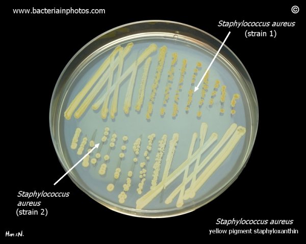 Золотистый стафилококк культуральные свойства