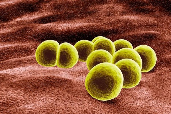 Сыпь атопического дерматита