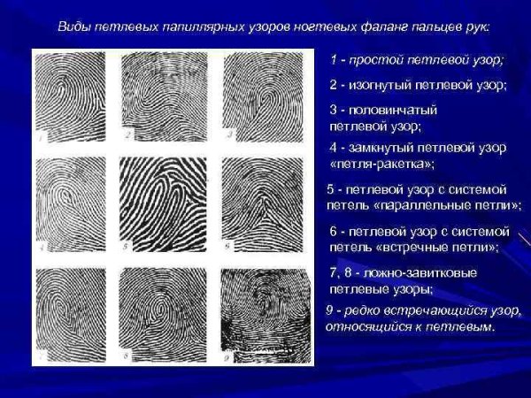 Строение папиллярного узора пальца