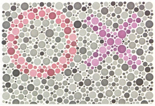 Дальтонизм цветоаномалия