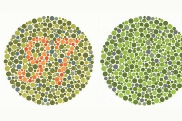 Дальтонизм цветоаномалия