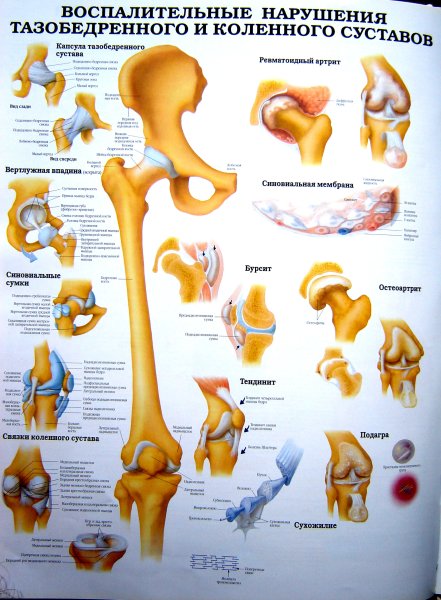 Вертлужная впадина тазобедренного сустава анатомия