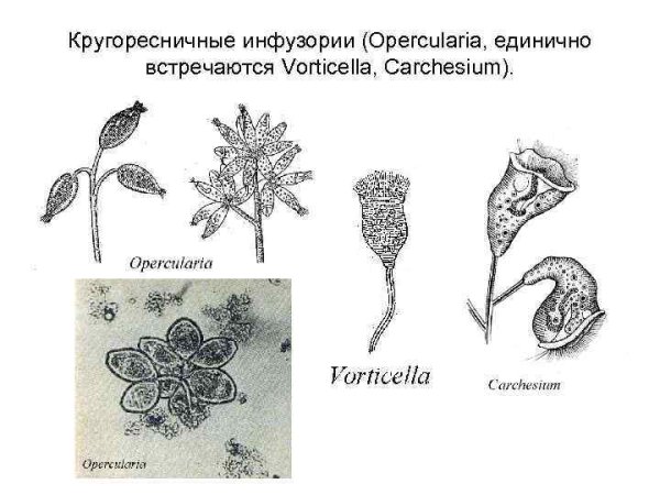 Кругоресничные инфузории Peritricha
