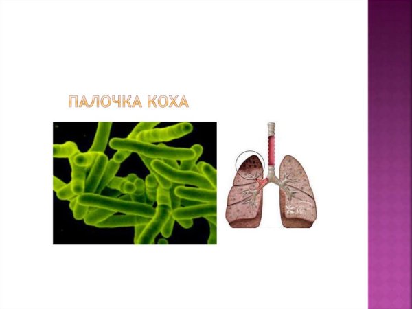 Палочка Коха профилактика
