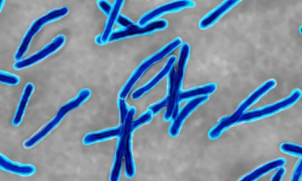 Палочка Коха микроскопия