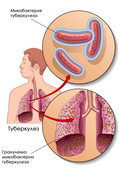 Строение микобактерии туберкулеза