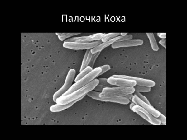 Палочка Коха возбудитель туберкулеза