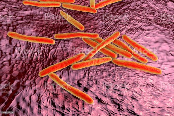 Палочка Коха гистология