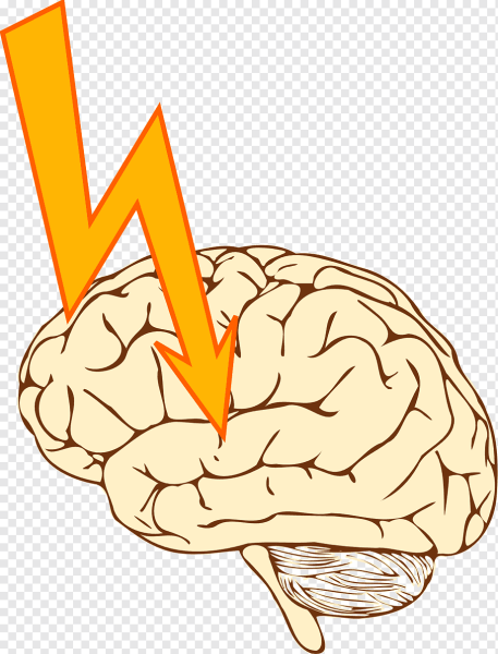 Инсульт картинки