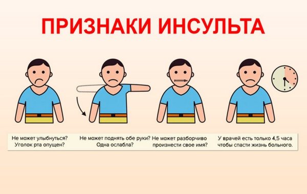 Основным признаком инсульта мозгового является: