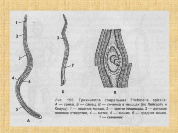 Трихинелла спиральная - Trichinella spiralis
