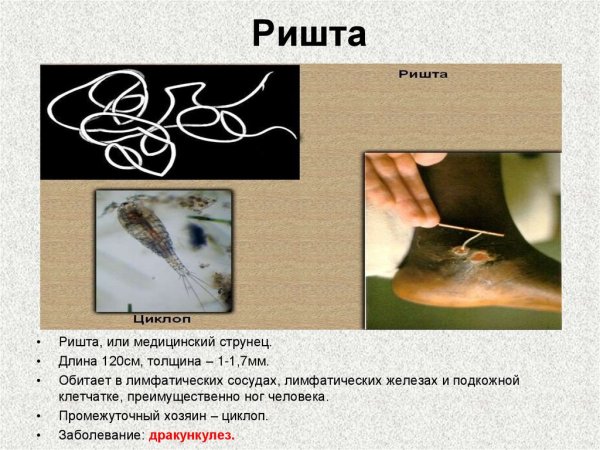 Паразитический червь ришта