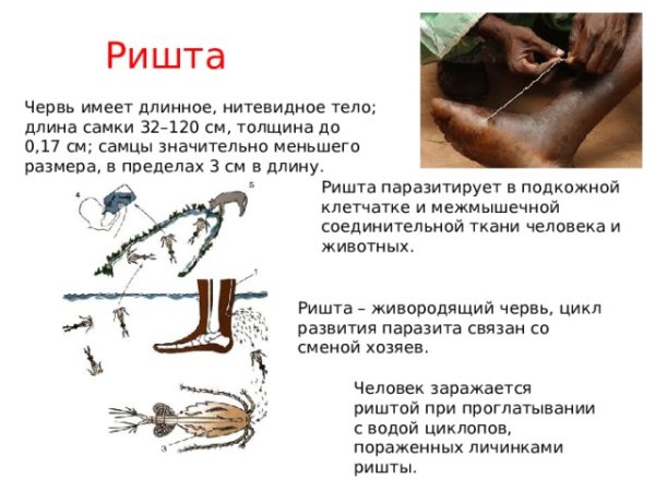 Ришта возбудитель дракункулеза