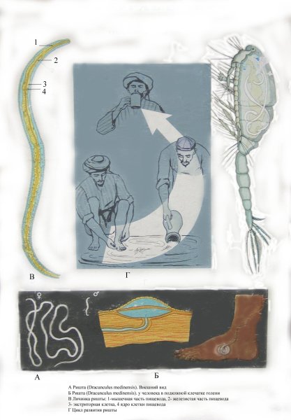 Ришта возбудитель дракункулеза