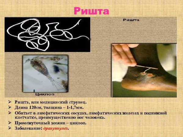 Ришта возбудитель дракункулеза