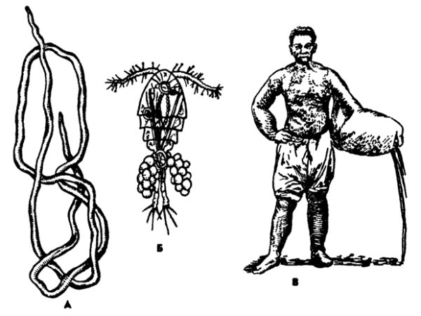 Ришта пищеварительная система