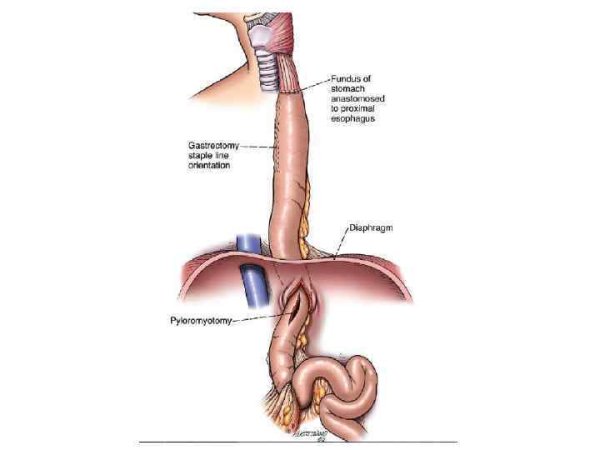 Строение пищевода человека анатомия