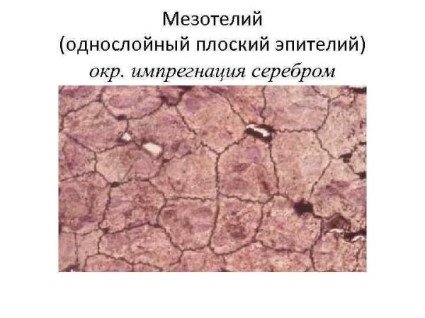 Однослойный плоский эпителий мезотелий сальника