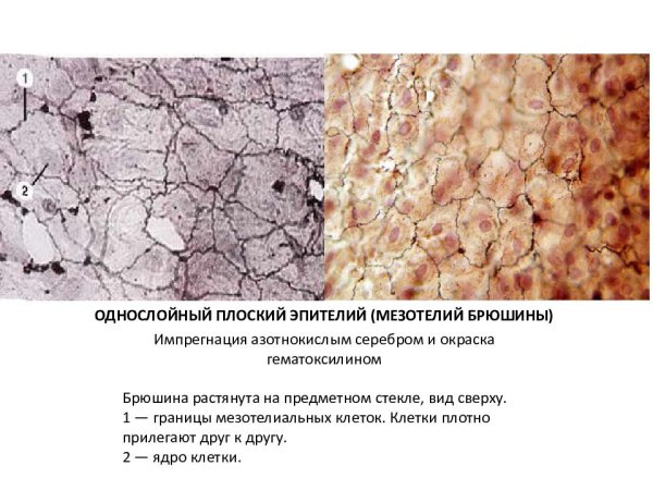 Однослойный плоский эпителий мезотелий функции