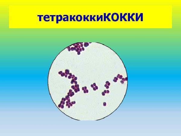 Формы бактериальных клеток кокки сферические