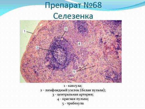 Белая пульпа селезенки гистология